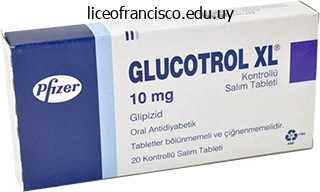 buy 10 mg glucotrol xl amex